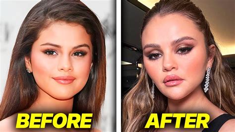 selena gomez breast|Selena Gomez Opens Up About Cosmetic Surgery & Reacts to。